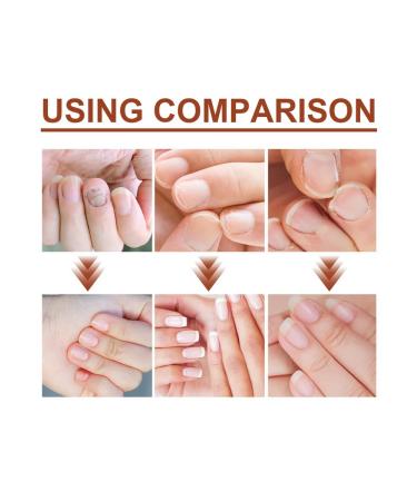 Essence for nail care for 7 days - Buy Online on GoSupps.com