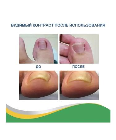 fix nails stickers Improve Jiagou Building 50pcs - Buy Online on GoSupps.com