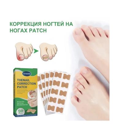 fix nails stickers Improve Jiagou Building 50pcs - Buy Online on GoSupps.com