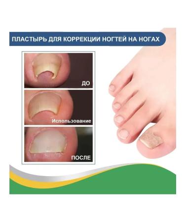 fix nails stickers Improve Jiagou Building 50pcs - Buy Online on GoSupps.com