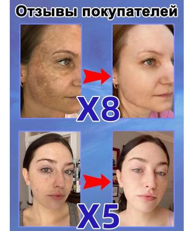 LYDIMOON Whitening cream 377 30 mi - Buy Online on GoSupps.com