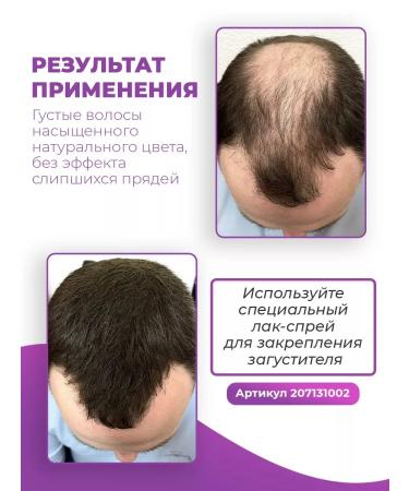 Sevich Thickener for hair golden color 100 grams - Buy Online on GoSupps.com