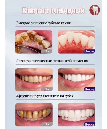 LYDIMOON Bleaching toothpaste 150 g - Buy Online on GoSupps.com