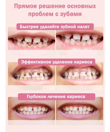 Children's toothpaste with fluorine and probiotics 0-12 years old. - Buy Online on GoSupps.com