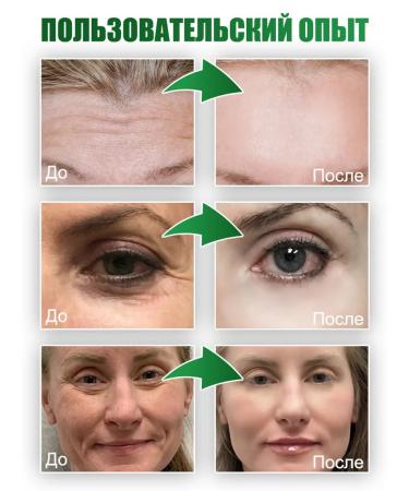 LYDIMOON Wheezero for the face moisturizing from wrinkles anti -aging - Buy Online on GoSupps.com