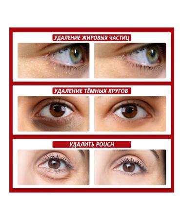 SOUTH MOON Eyes Care Essence Elimination of Fat Knocks Dark Circles - Buy Online on GoSupps.com