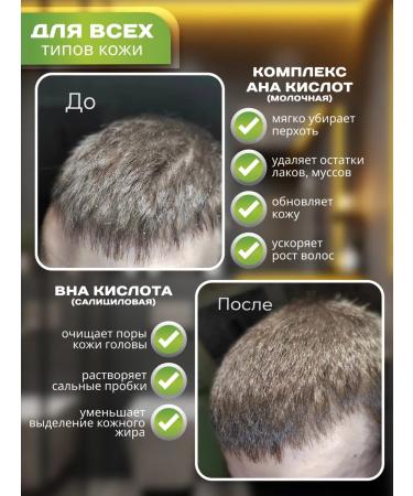 lezzeteco Pilling from dandruff - Buy Online on GoSupps.com