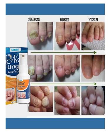 DRSKINVITA Spray from nail fungus fast effect 30ml - Buy Online on GoSupps.com