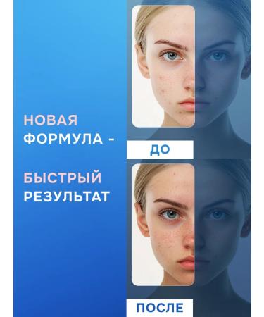 Acne Control Salicylic masking face pencil - Buy Online on GoSupps.com