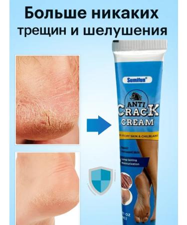 Aku15 Cream for hands and legs from dryness and cracks - Buy Online on GoSupps.com