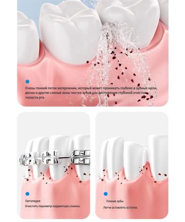 Xiaomi Irrigator for teeth and gums portable - Buy Online on GoSupps.com