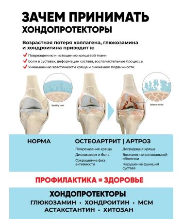 IQTON Collagen for joints for women - Buy Online on GoSupps.com