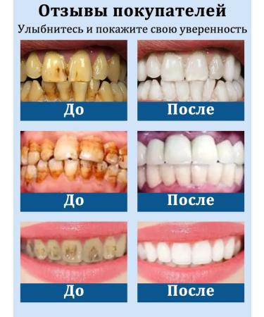 Lydimoon toothpaste from pollution against caries - Buy Online on GoSupps.com