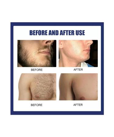 3 cream for permanent hair removal - a remedy for removing boron - Buy Online on GoSupps.com