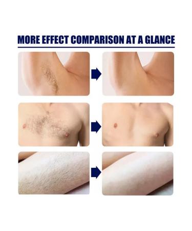 3 cream for permanent hair removal - a remedy for removing boron - Buy Online on GoSupps.com