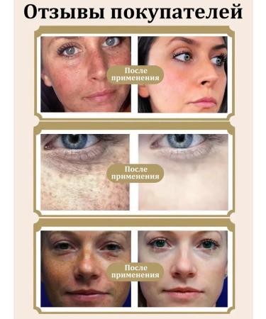 Cream against pigmentation clarification and removal of spots - Buy Online on GoSupps.com