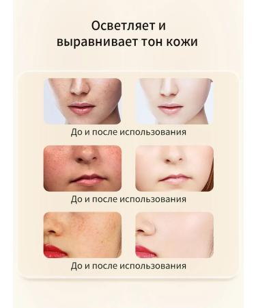 Cream against pigmentation clarification and removal of spots - Buy Online on GoSupps.com