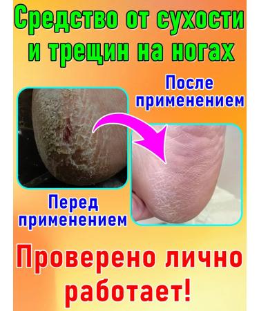 Moisturizing nourishing cream for legs and hands from cracks