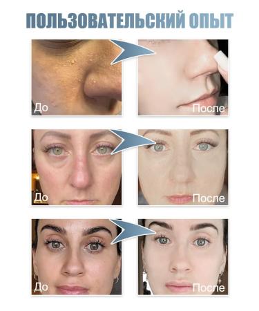 LYDIMOON Thermal water for the face moisturizing skin moisturizing - Buy Online on GoSupps.com