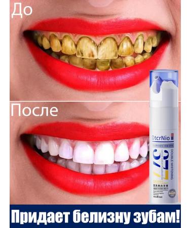 Whitening toothpaste eliminates pigmentation on the teeth