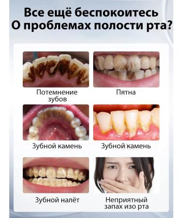 Whitening toothpaste eliminates pigmentation on the teeth - Buy Online on GoSupps.com