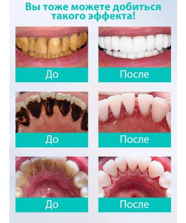 Whitening toothpaste eliminates pigmentation on the teeth - Buy Online on GoSupps.com