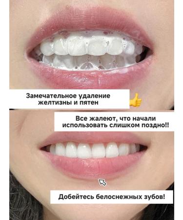 Whitening toothpaste eliminates pigmentation on the teeth - Buy Online on GoSupps.com