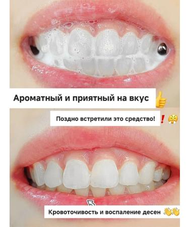 Whitening toothpaste eliminates pigmentation on the teeth - Buy Online on GoSupps.com