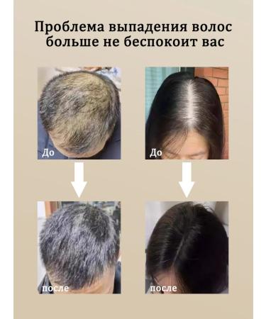 LYDIMOON Hair growth spray with ginger 30 ml - Buy Online on GoSupps.com