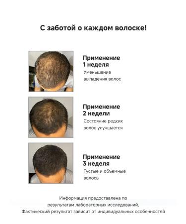 LYDIMOON Hair growth spray 30ml*3 - Buy Online on GoSupps.com