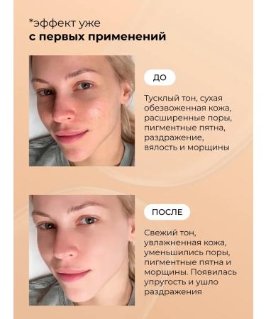 STARBERRY A set of facial serums with hyaluronic acid 24V1 - Buy Online on GoSupps.com