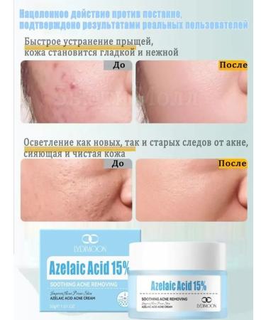 LYDIMOON Acne cream with azelainic acid 30 g - Buy Online on GoSupps.com