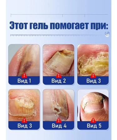 Antifungal ointment from nail fungus and feet - Buy Online on GoSupps.com