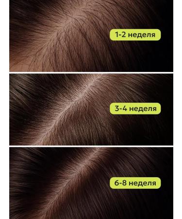 Likato professional Hair growth with rosemary strengthening 2*150 ml - Buy Online on GoSupps.com