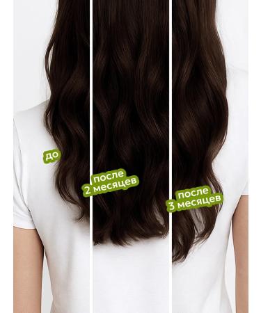 Likato professional Set for hair growth tonic and oil to strengthen - Buy Online on GoSupps.com