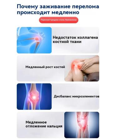 Cream for quick removal of pain in joints 110 g - Buy Online on GoSupps.com