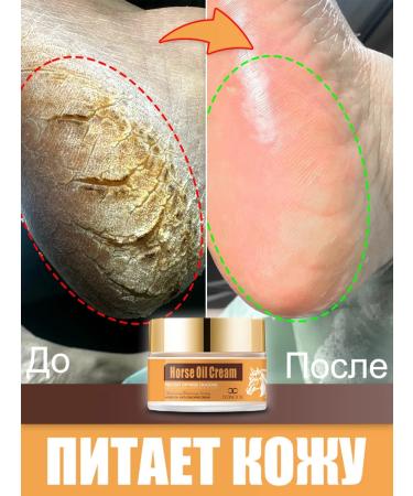LYDIMOON Foot cosmetics from corns and cracks on the heels