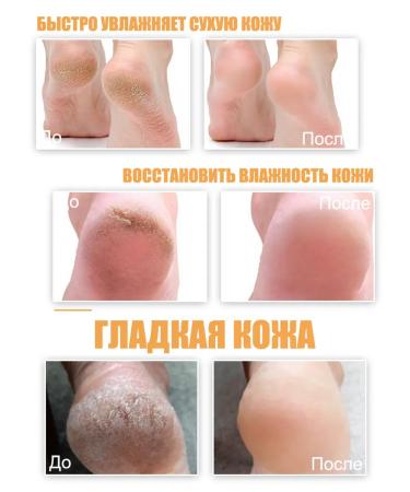 LYDIMOON Foot cosmetics from corns and cracks on the heels - Buy Online on GoSupps.com