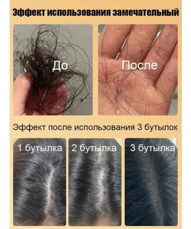 Shampoo against falling out and for the growth of the wave （5 bottles） - Buy Online on GoSupps.com