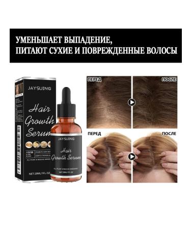 JaySuing Prevent hair loss Essence nourishes the scalp - Buy Online on GoSupps.com