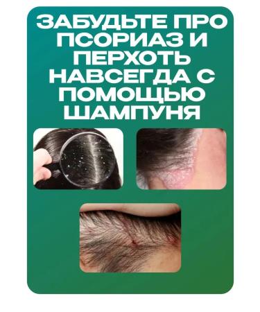 Zudaifu dandruff shampoo for all hair types 120 ml - Buy Online on GoSupps.com