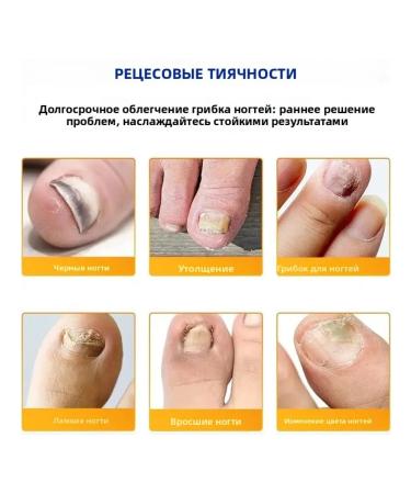 Delicate patching from nail fungus are easy to use p - Buy Online on GoSupps.com
