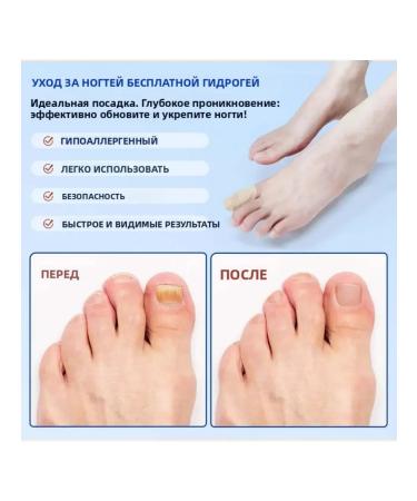 Delicate patching from nail fungus are easy to use p - Buy Online on GoSupps.com