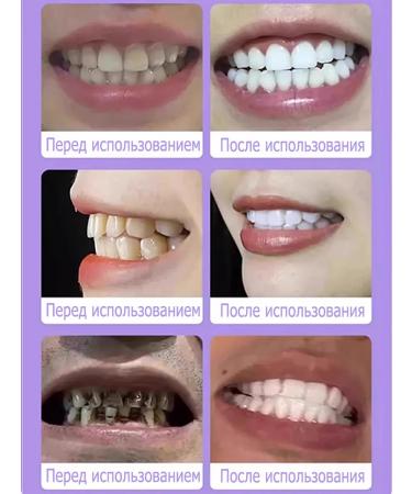 Toothpaste for sensitive teeth and gums 30 ml - Buy Online on GoSupps.com