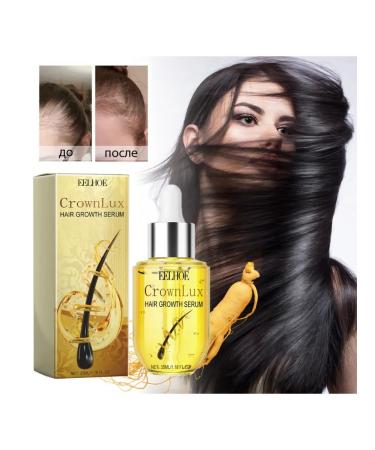 eelhoe Strong against hair loss Scalp Power Putation Care Essence - Buy Online on GoSupps.com
