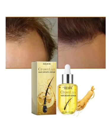 eelhoe Strong against hair loss Scalp Power Putation Care Essence - Buy Online on GoSupps.com