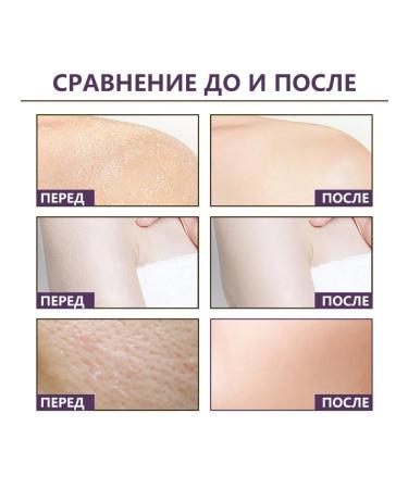 Whitening the struggle of chicken skin nicotinamide blackberry scrub - Buy Online on GoSupps.com