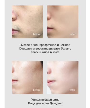 Moisturizing and cleansing face washing gel - Buy Online on GoSupps.com