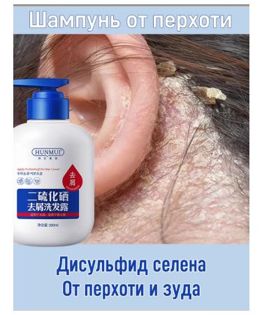 Hunmui Anti-dandruff shampoo with selenium disulfide against seborrhea and itching 250 ml