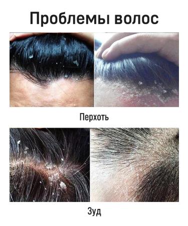 Hunmui Anti-dandruff shampoo with selenium disulfide against seborrhea and itching 250 ml - Buy Online on GoSupps.com